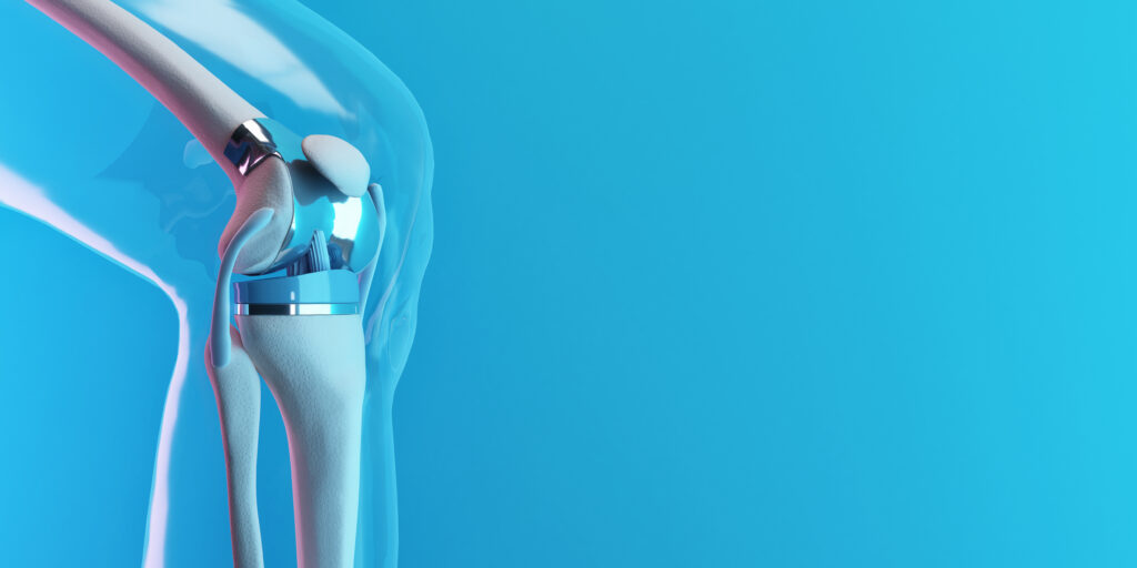 The Different Types of Anesthesia for Joint Replacement